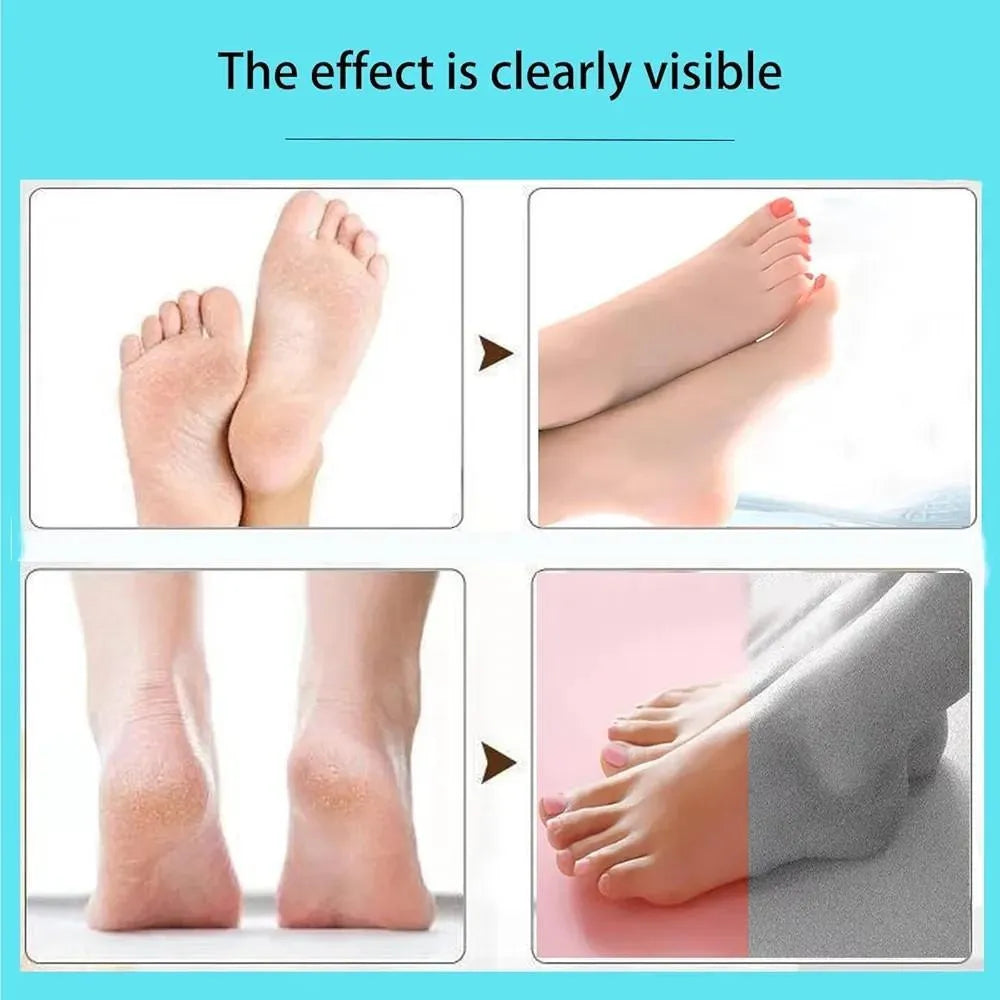 Rechargeable Electric Foot Callus Remover with LED Light
